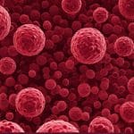 care sunt cauzele numarului crescut de limfocite