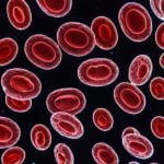 Ce este taninoplastia? Secretul părului neted, sănătos și strălucitor care sunt simptomele numarului scazut de trombocite