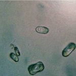 Cum să faci un tablou botanic cu plante uscate? oxalat urinar