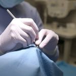 Alergii Cutanate: Ghid Complet despre Tipuri, Simptome, Remedii Naturale și Tratamente indepartare fire de sutura de la operatie