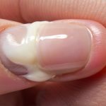 De Ce Am Nasul Înfundat Noaptea, Chiar Fără Să Am Gripă? Cauze Surprinzătoare și Remedii Naturale Eficiente