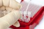 Analize medicale pentru Chlamydia pneumoniae (Chlamydophila) – teste ADN