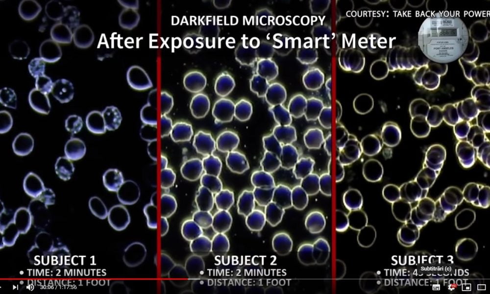 pericolele radiatiilor antenelor