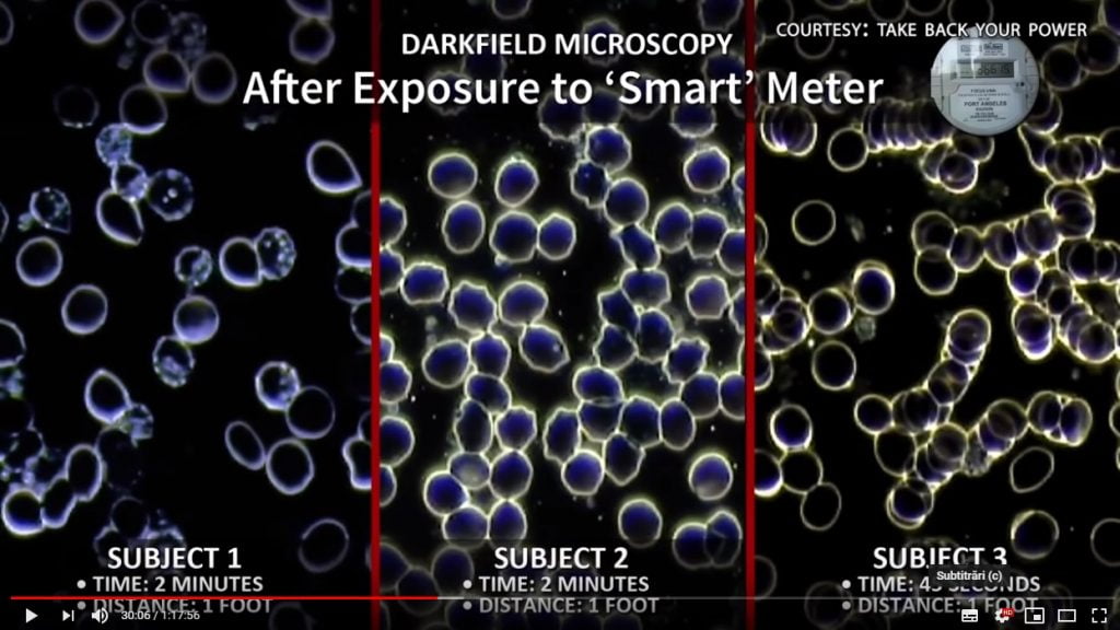 pericolele radiatiilor antenelor