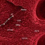 din ce cauza creste nivelul de gamma gt