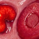 ghid de ingrijire a bolnavului de cancer