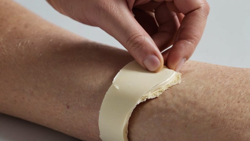 cum se indeparteaza plasturele de pe rana