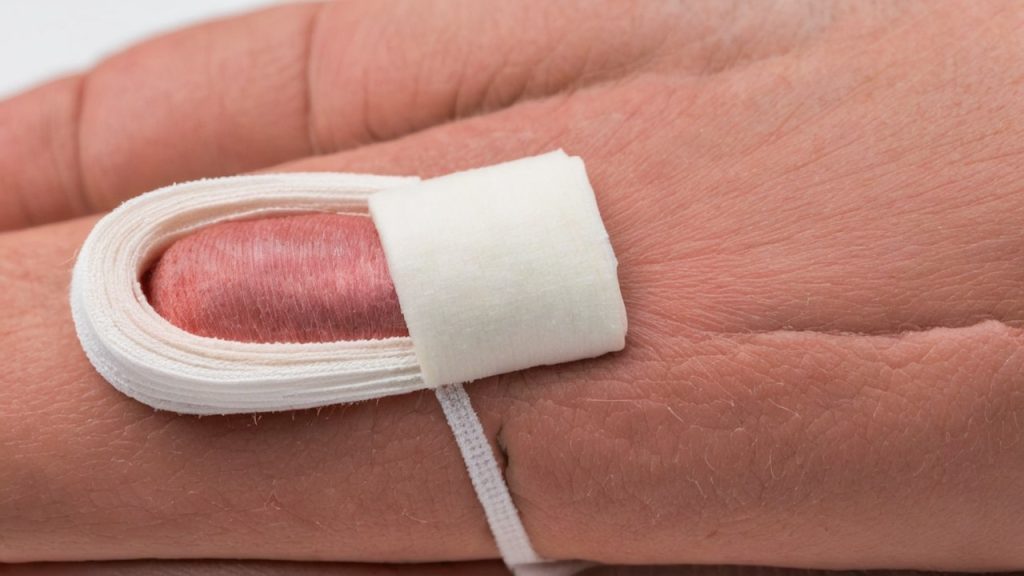 Cum să știi dacă o rană este infectată? Un ghid complet pentru recunoașterea, prevenirea și tratarea infecțiilor cutanate