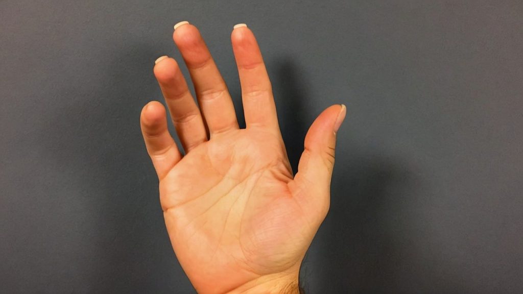 Ce Trebuie Să Faci Să Nu Îți Mai Tremure Mâinile? Un Ghid Complet