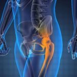 ce este scintigrafia