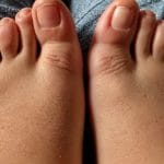 cum sa eviti retentia de apa