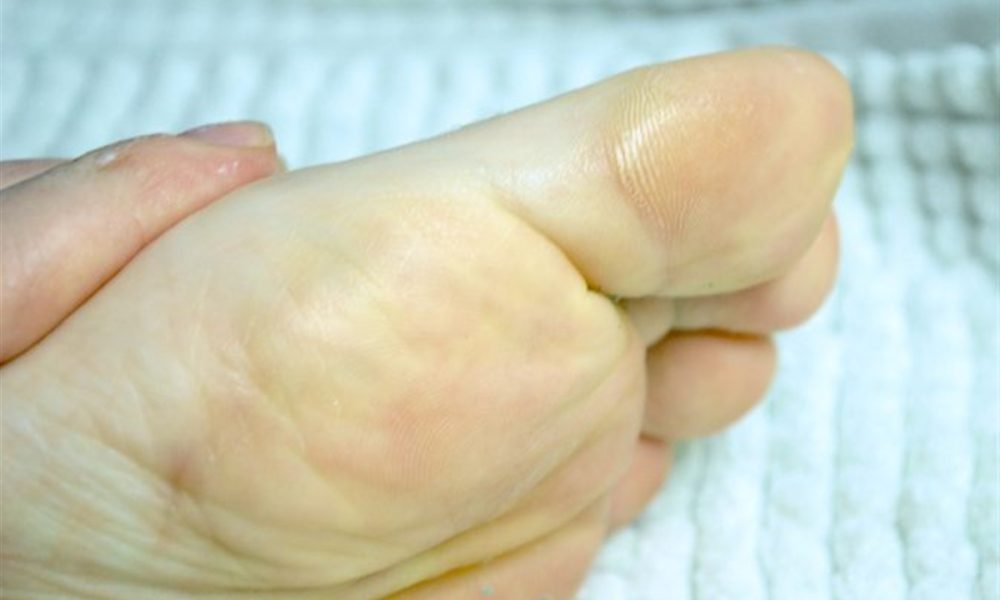 Cum tratezi pielea uscată pe picioare cu acid glicolic?