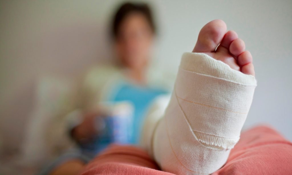 Cum să îndepărtaţi ghipsul de pe mână sau picior?