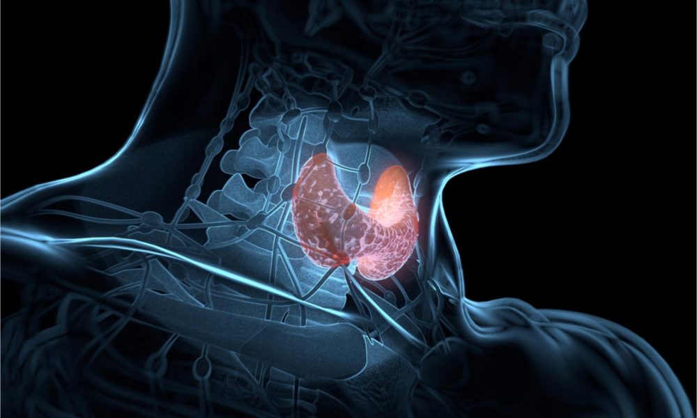 Ce organe afectează glanda tiroidă? organele afectate de glanda tiroida