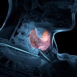 organele afectate de glanda tiroida