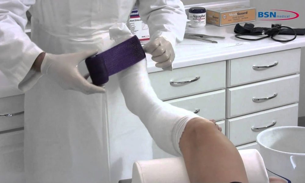 Ce trebuie si ce nu trebuie sa faceti dupa indepartarea ghipsului