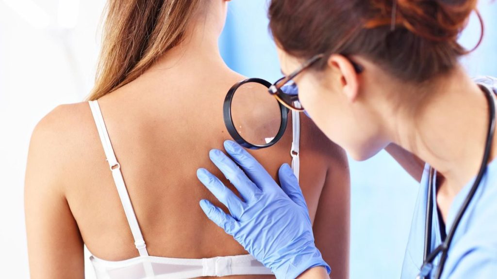 Cum se trateaza molluscum contagiosum