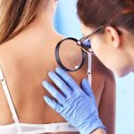 Cum se trateaza molluscum contagiosum