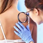 Cum se trateaza molluscum contagiosum