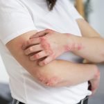 Idei de nume de magazine de îmbrăcăminte: găsește denumirea ideală pentru afacerea ta diata vindeca psoriazisul