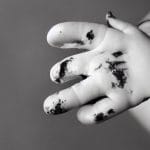 Ce sa faci daca copilul s a ars la deget