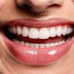 cel mai bun adeziv pentru protezele dentare