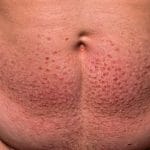 Cum să faci o plângere unui polițist: Ghidul cetățeanului informat unde apare zona zoster